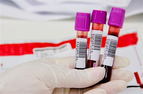 jejum exame de sangue-1